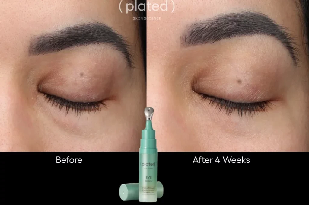 Before-afrerimage_D-PRP Treatments In Las Vegas, NV