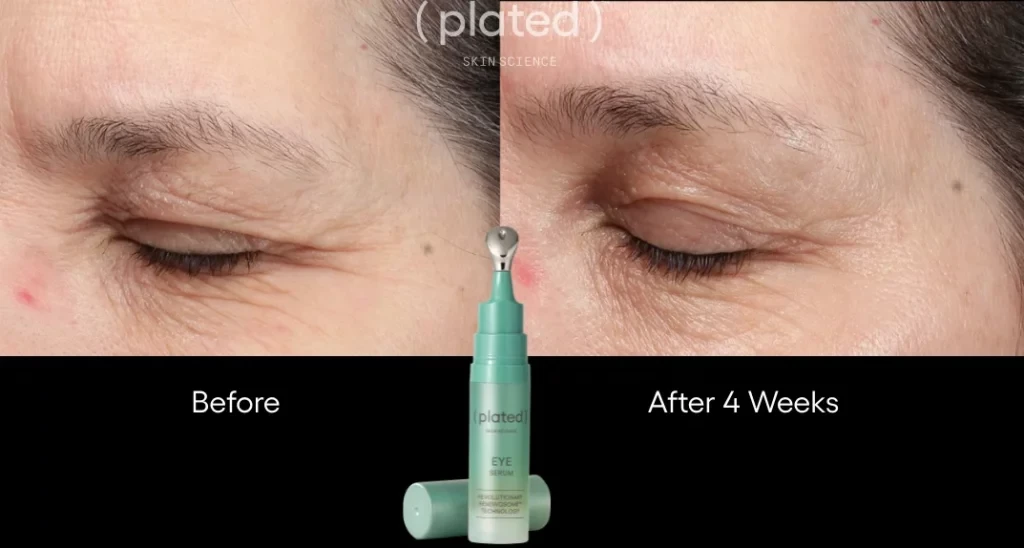 Before-afrerimage_E-PRP Treatments In Las Vegas, NV