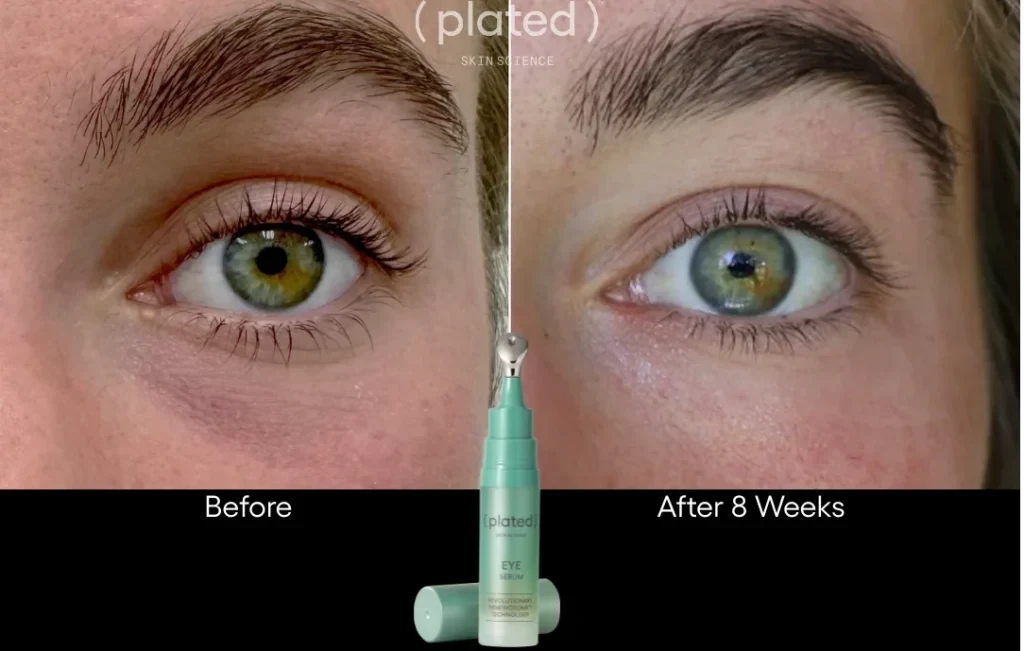 Before-afrerimage_F-PRP Treatments In Las Vegas, NV