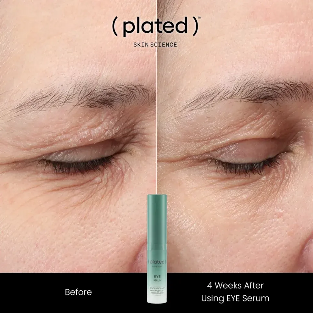 Before-afrerimage_J-PRP Treatments In Las Vegas, NV